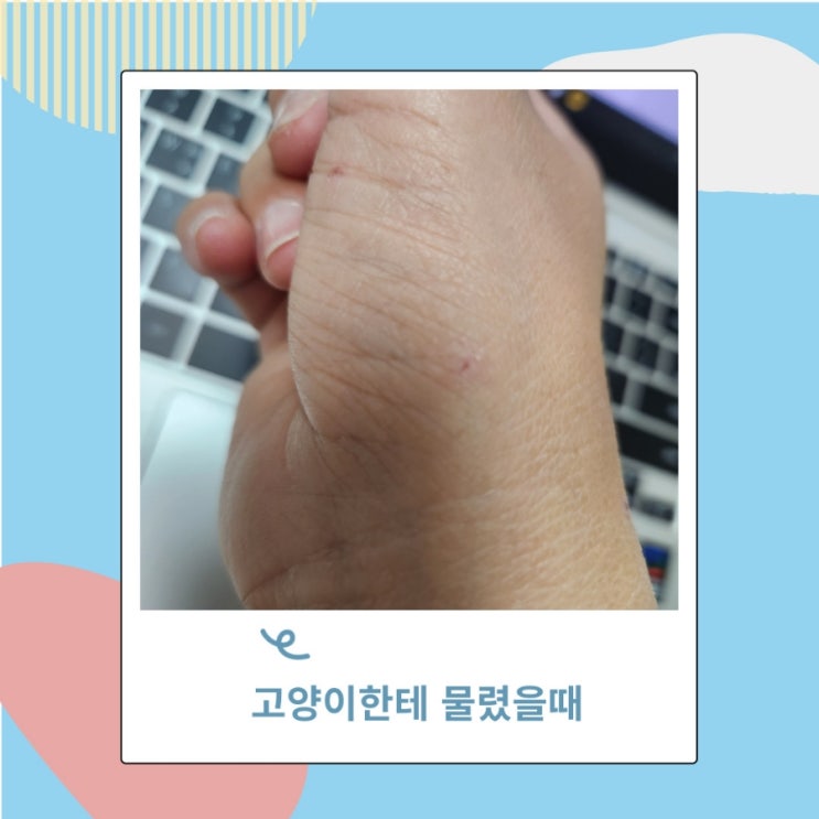 고양이한테 물렸을때 병원 진료 가야 할까?