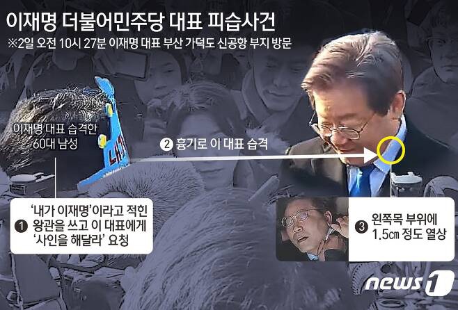'<b>피습</b>' <b>이재명</b>, 혈관재건술 받아…"2시간 수술, 중환자실서... 