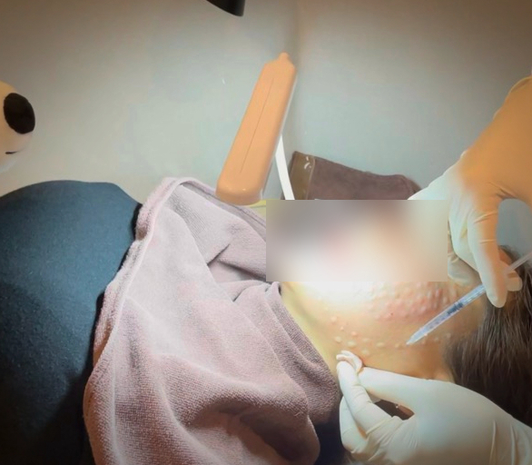 서면 스킨보톡스 이 1가지로 효과 갈립니다. 서면 스킨보톡스 이 1가지로 효과 갈립니다.