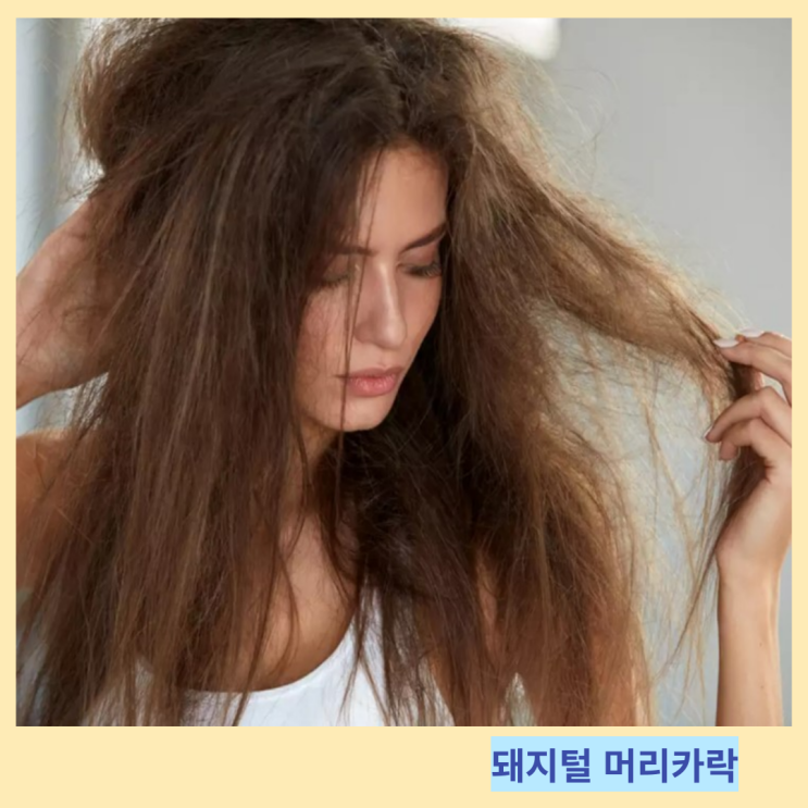 돼지털 머리카락 원인 및 바른 관리법 돼지털 머리카락 원인 및 바른 관리법