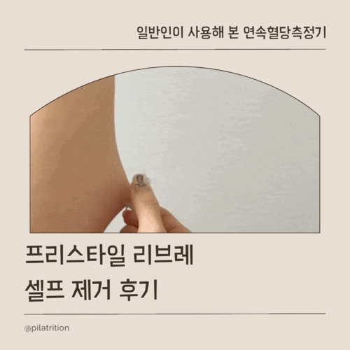 리브레 제거 후 흉터 연속혈당측정기 셀프제거 해봤어요