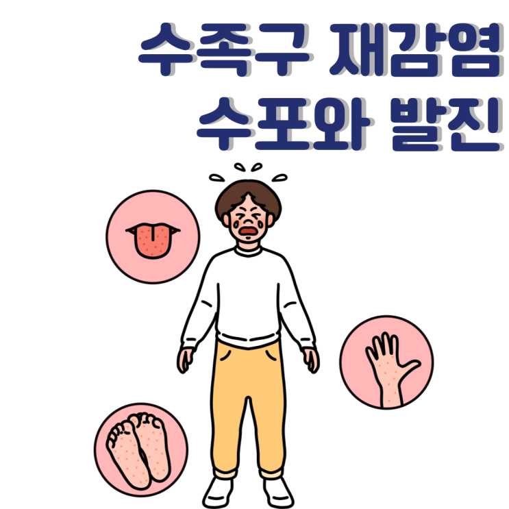  수족구 재감염 : 전염 수포와 발진