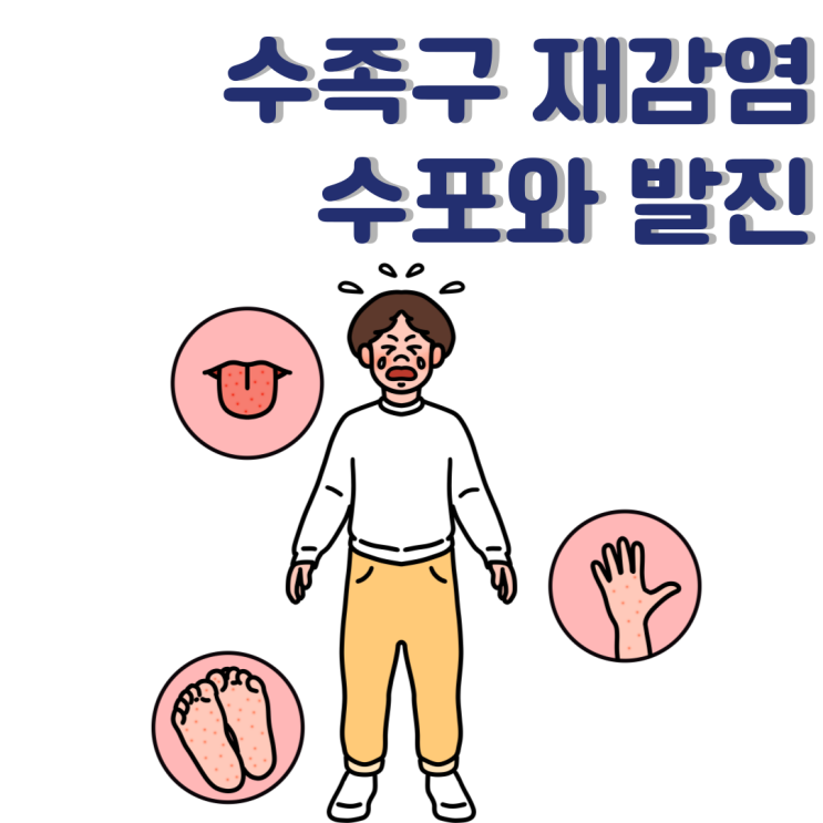 수족구 재감염 : 전염 수포와 발진