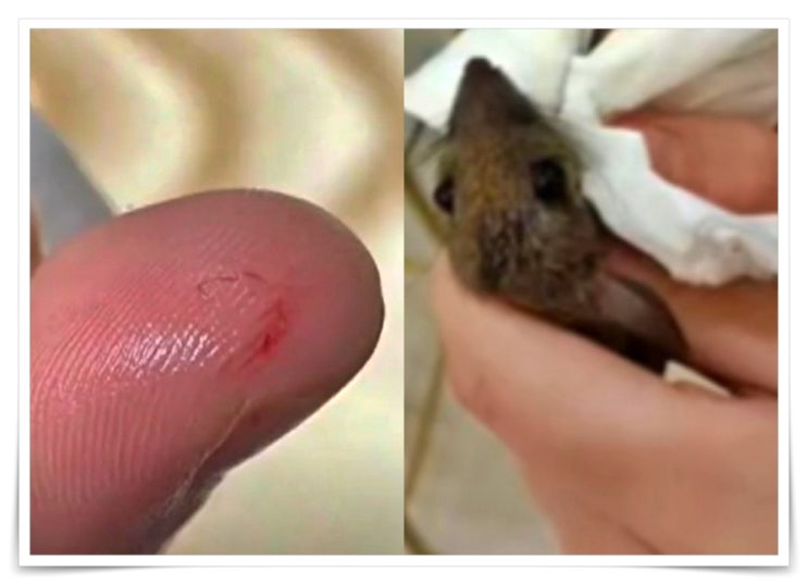 쥐가 자신의 손가락을 물자 '더 잔인한' 방법으로 복수한 여대생