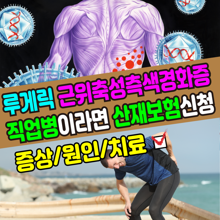  [건강정보] 루게릭병 / 근위축성측색경화증(증상,치료,원인) 직업병 산재보험 신청