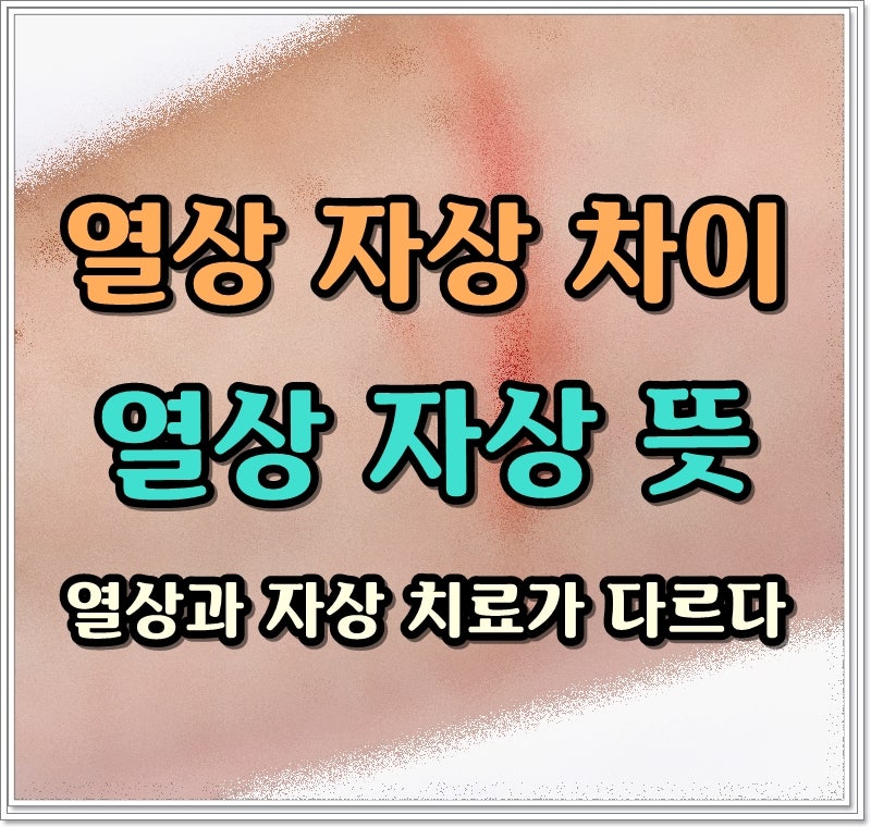 열상 자상 차이 뜻 열상과 자상 위험한 것은?