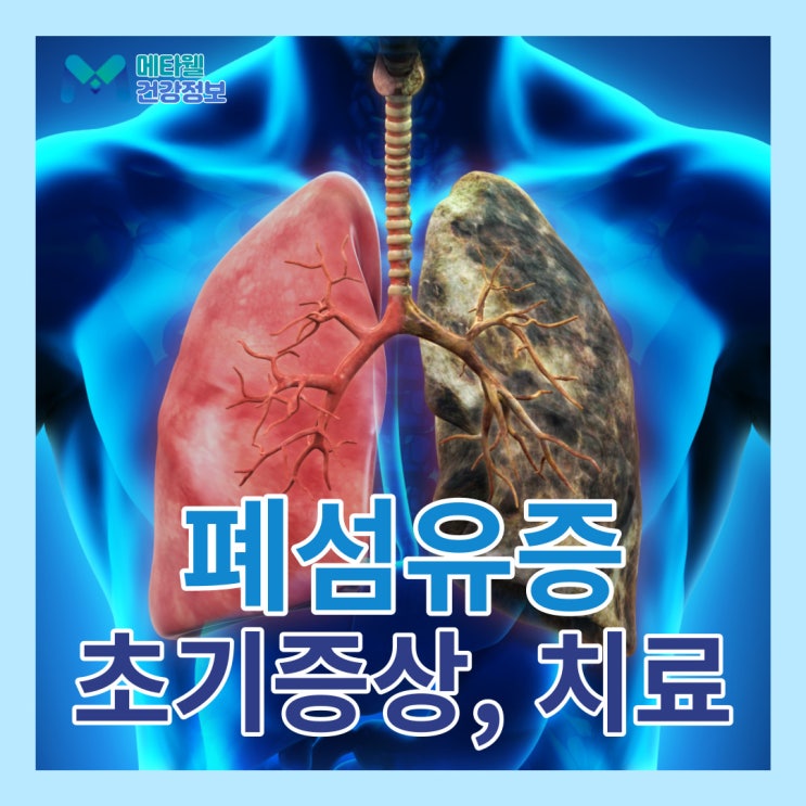 예후 안 좋은 특발성 폐섬유증 초기 증상, 폐섬유화의 원인과 관리 및 치료방안