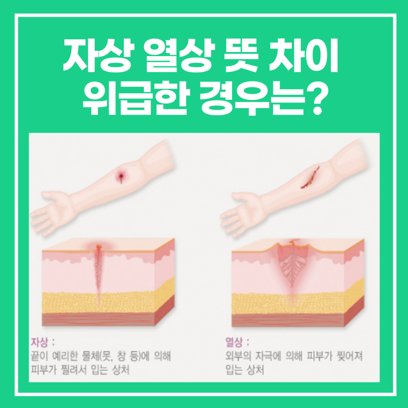 열상 자상 뜻 차이 위급한 경우는?(응급처치 방법)