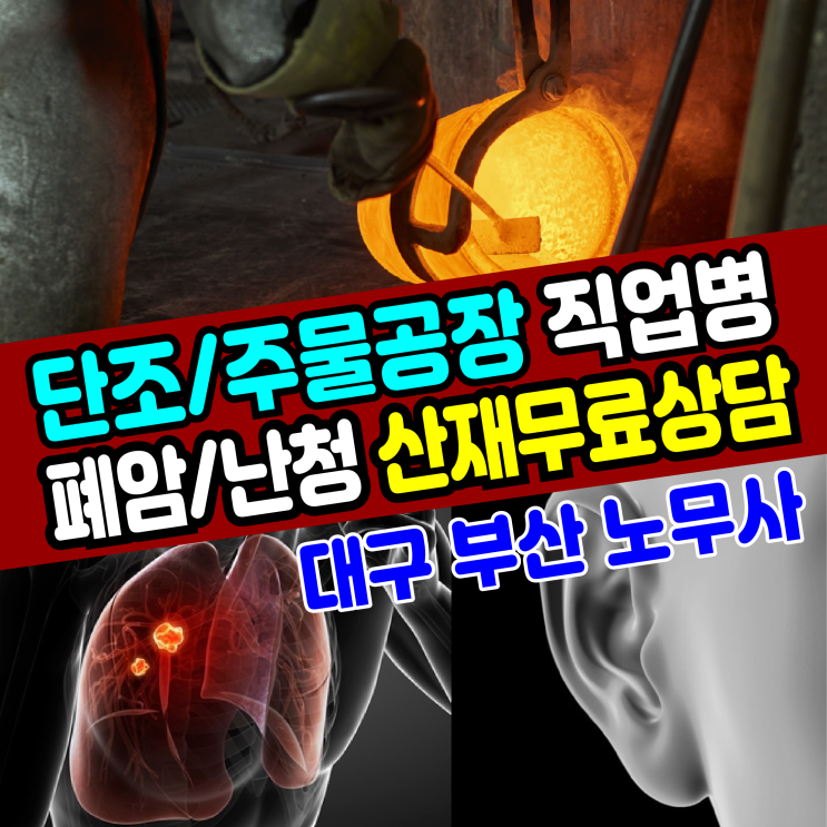  [대구/부산 노무사] 단조 주물공장 직업병(폐암/난청) 산재 무료 상담
