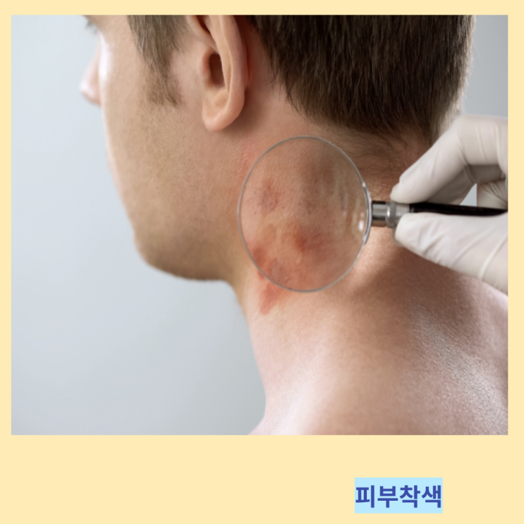 목 겨드랑이 착색 원인 및 피부착색 바른 관리방법 목 겨드랑이 착색 원인 및 피부착색 바른 관리방법