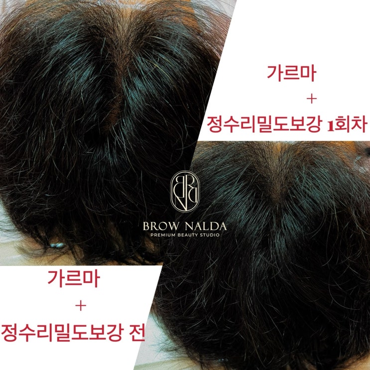  호매실동두피문신 다신 없을 이벤트 보너스 2달 치 합쳐서라도 잡자.