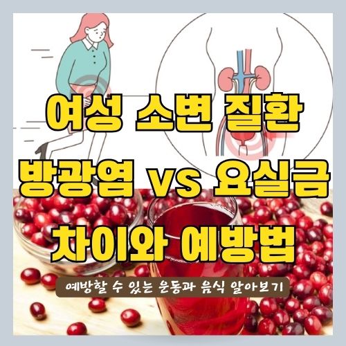 오줌이자주마려워요 - 방광염과 요실금의 원인과 예방 및 차이점[ 케겔운동 | 크랜베리 ]