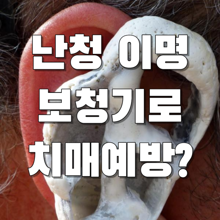  난청 이명 보청기 로 치매예방까지 할수 있다?
