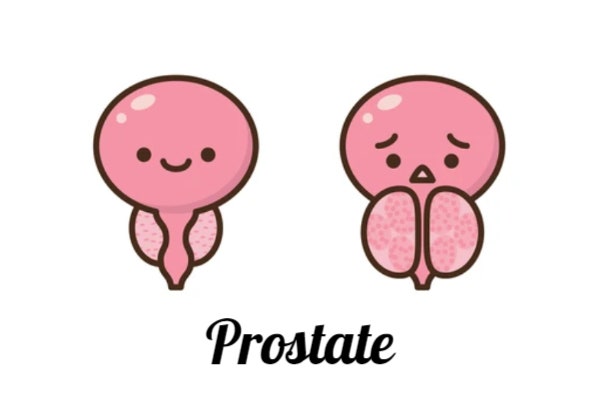  Prostate 전립선 영양제 가성비 좋은 미국산