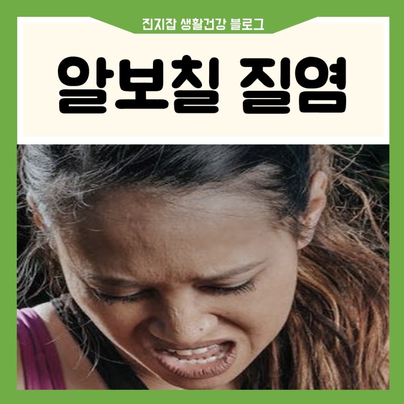알보칠 질염 사용법 편의점 통증 원리 면봉