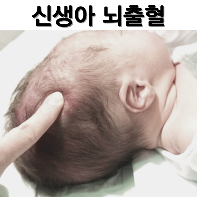 신생아 뇌출혈 증상 원인 치료방법 자세히!