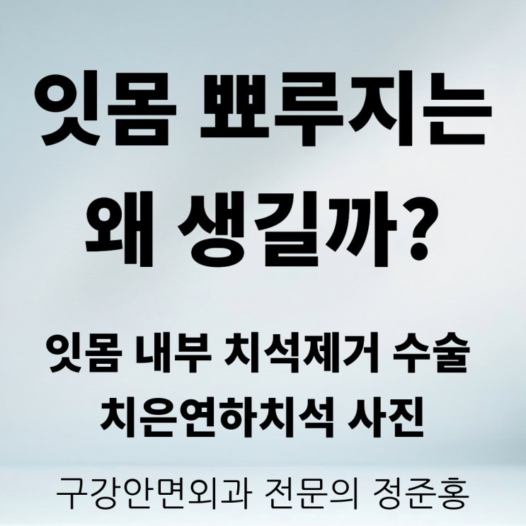  잇몸 뾰루지는 왜 생길까? 잇몸 내부 치석 제거 수술, 치은연하치석 사진