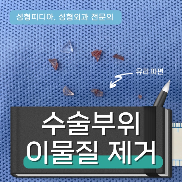 [열상] 상처 봉합 전 이물질 제거술 (feat. 성형외과 전문의)