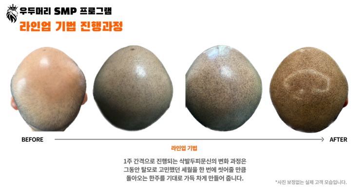  울산두피문신 삭발전문업체 찾는 방법 3번이상 보세요