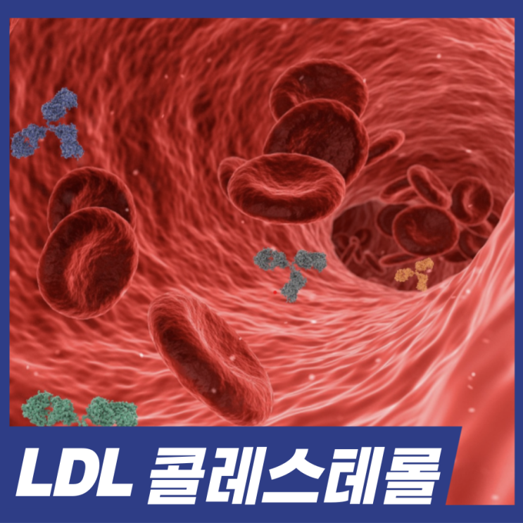  LDL 콜레스테롤 심근경색? 정상수치 낮추는 방법