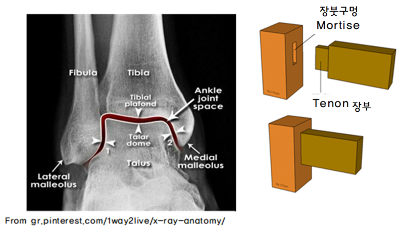 귀띔 10화 Ankle 검사에서 Mortise는 사람 이름인가요? : 네이버 블로그