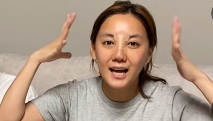 고은아, "<b>중형차</b> 한 대 값" 코 재<b>수술</b> 후 첫 방송…모발이식 고백도