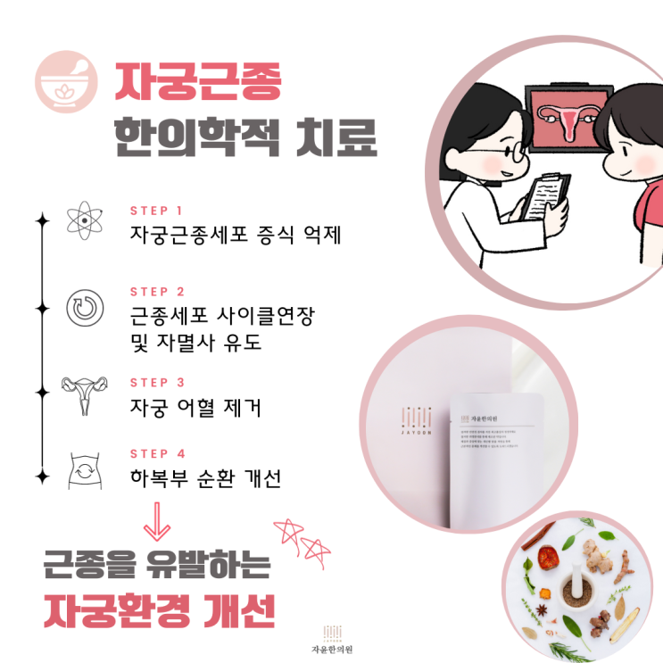  산본자궁근종 한약 치료 기전, 효과, 주의해야 할 음식
