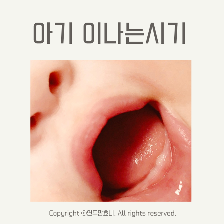 아기 이나는시기 순서 신생아 첫니 어금니 윗니 이빨 치아 영구치 아기 이나는시기 순서 신생아 첫니 어금니 윗니 이빨 치아 영구치