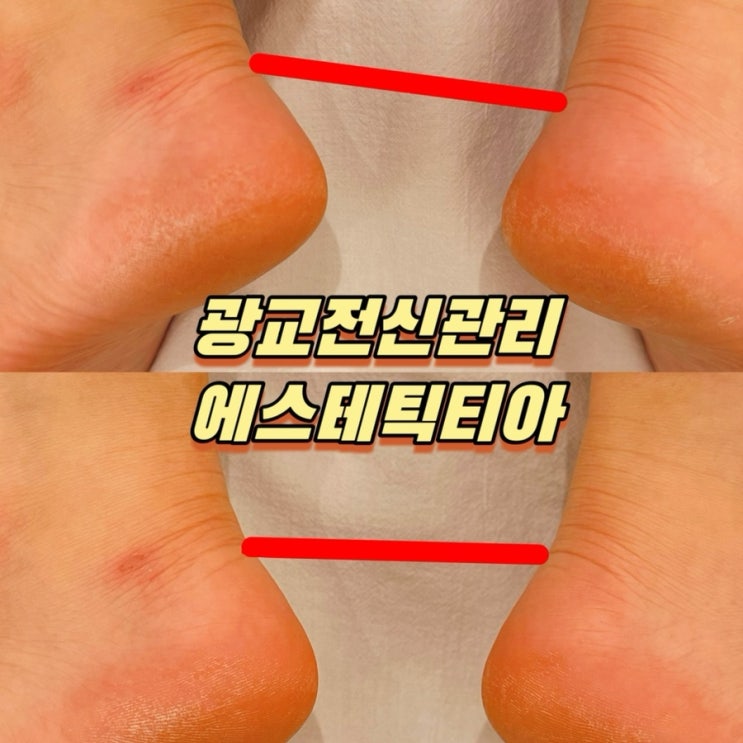  광교전신관리 에스테틱티아