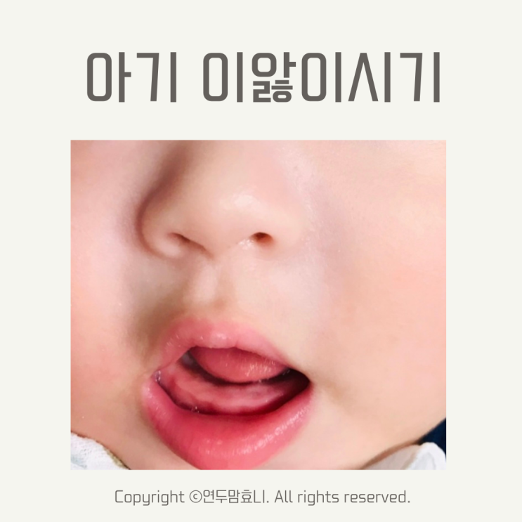 아기 이앓이 시기 증상 신생아 4개월 열 완화 이날때 오사닛캔디 아기 이앓이 시기 증상 신생아 4개월 열 완화 이날때 오사닛캔디