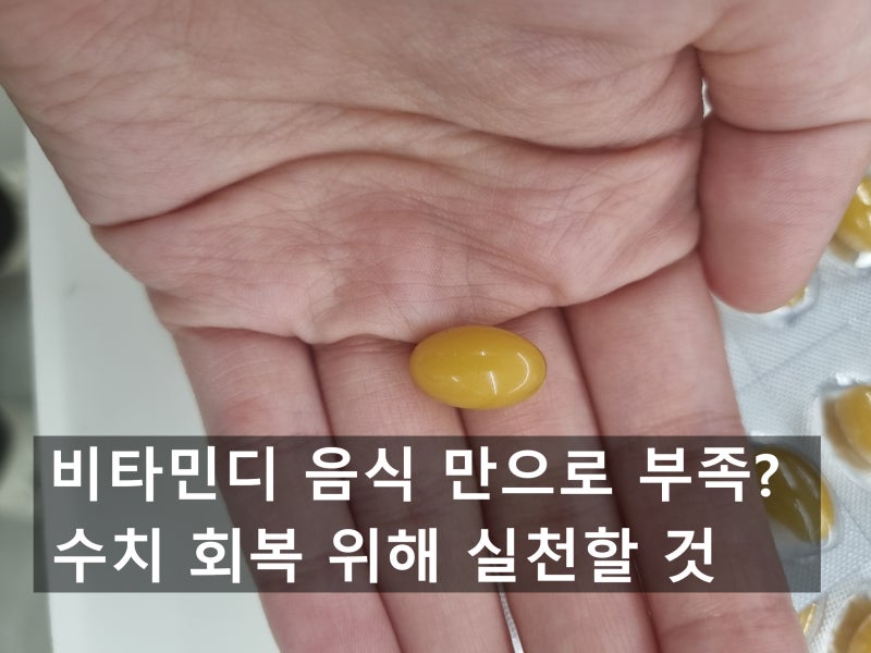 비타민디 음식 만으로 부족? 수치 회복 위해 실천할 것