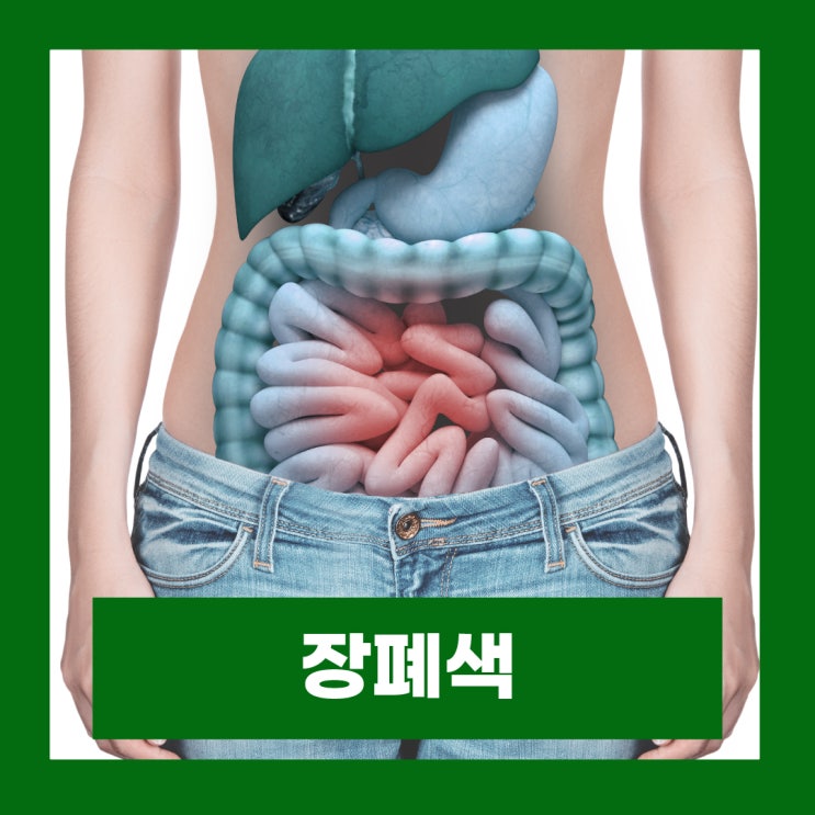  장폐색 입원 장이 꼬이는 느낌 꼬였을때 장꼬임 증상 수술 후기