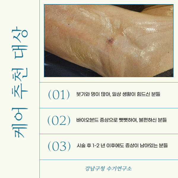  지방흡입 후관리샵 수기연구소에 가장 많이 문의주시는 3 가지