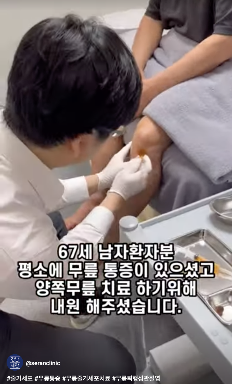  줄기세포 무릎주사 시술 스토리~60대/남성/양쪽무릎