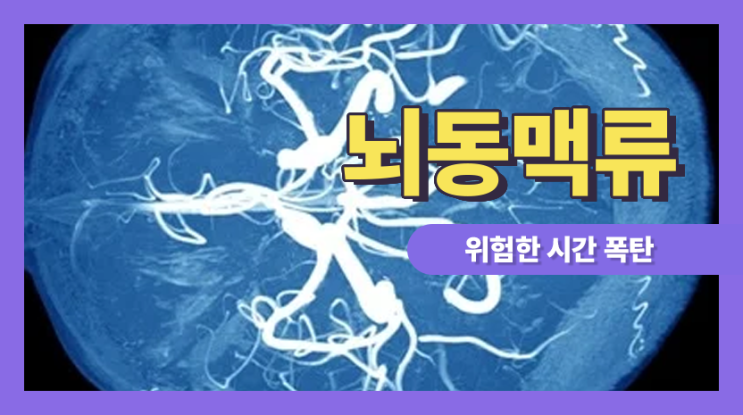  뇌동맥류 꽈리, 위험한 시간폭탄