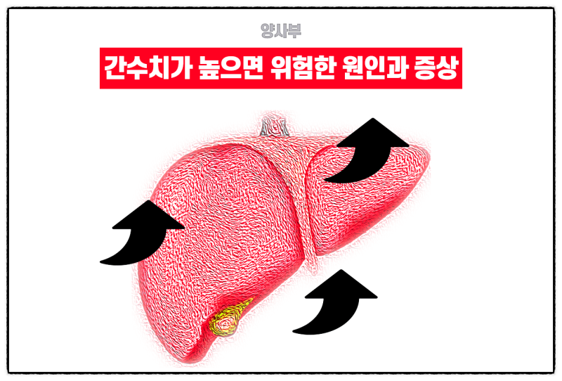 간수치가 높으면 위험한 원인과 증상