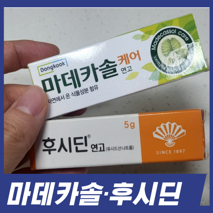  마데카솔 후시딘 차이점! 성분 효능 상황에 따라 사용하세요.