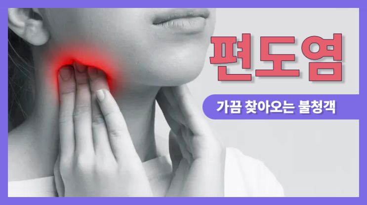  편도염, 가끔 찾아오는 불청객 대하기
