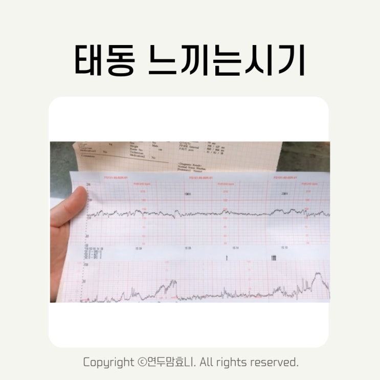 태동 느끼는시기 임신 막달 검사 줄어듬 비용 시간 태아 딸꾹질 태동 느끼는시기 임신 막달 검사 줄어듬 비용 시간 태아 딸꾹질