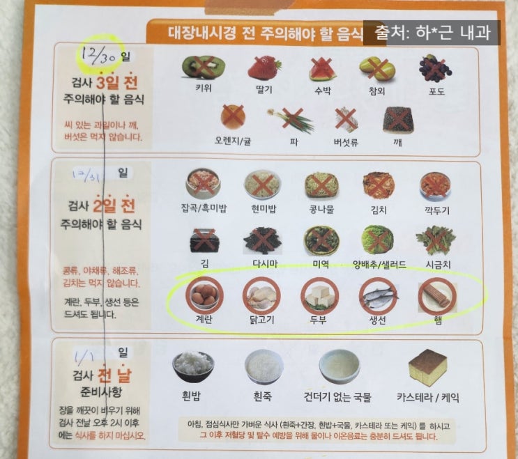  2024. 대장내시경 약 복용 방법, 후기 적어본다.