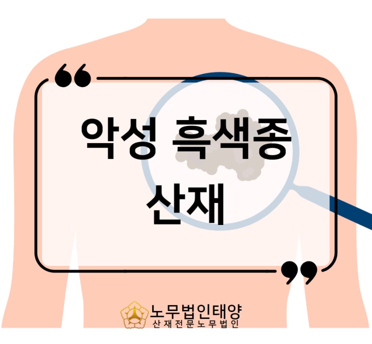  피부암 악성흑색종 산재 원인 인정기준 및 승인사례