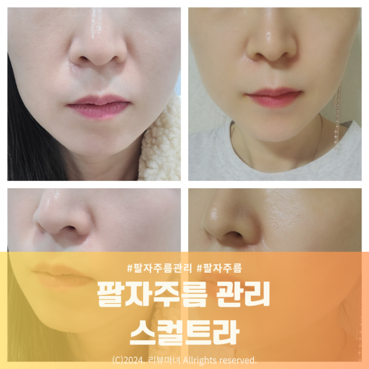  팔자주름 관리로 한살이라도 어려 보이자!