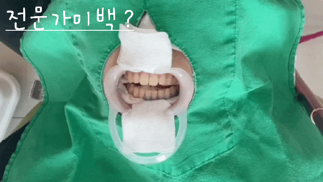 [강남역 치과] 치아미백 종류 및 방법