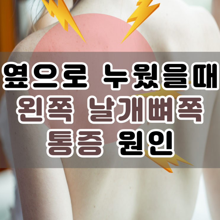  부산 재활 PT 옆으로 누우면 왼쪽 날개뼈 통증 원인과 해결법