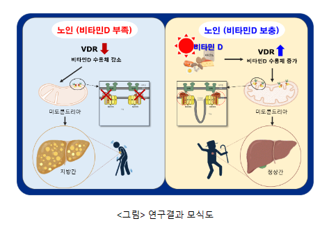 비타민 D, 노인성 지방간 예방의 새로운 희망 비타민 D, 노인성 지방간 예방의 새로운 희망