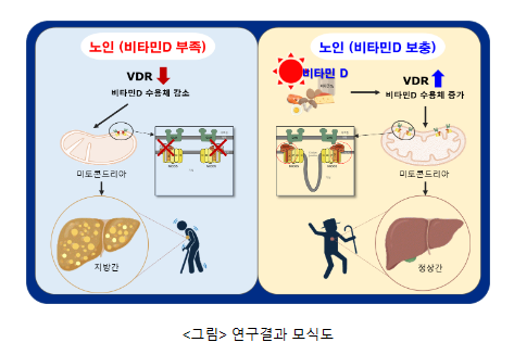 비타민 D, 노인성 지방간 예방의 새로운 희망