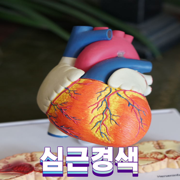  체한 듯한 통증 심근 경색? 원인 증상