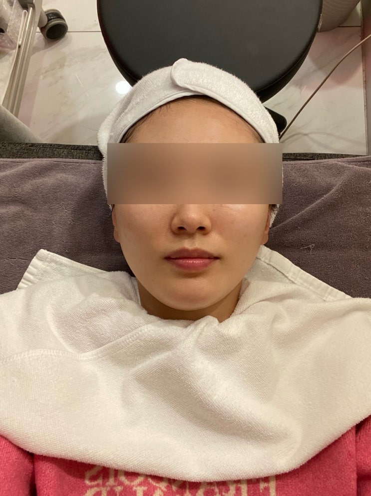  피부과 기록_ 스킨보톡스, 엑셀브이, 티파니 고주파, 광선 진정관리, 사마귀제거 등