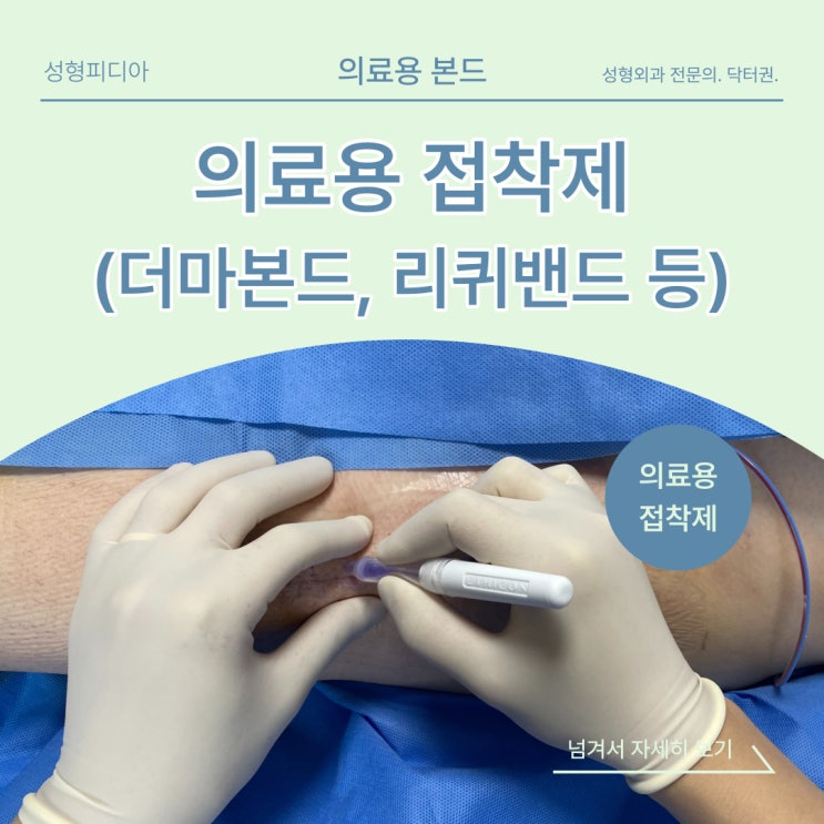 [의료용 접착제] 상처 치료에 더마본드, 리퀴밴드 믿고 사용해도 될까요? (feat. 성형외과 전문의)