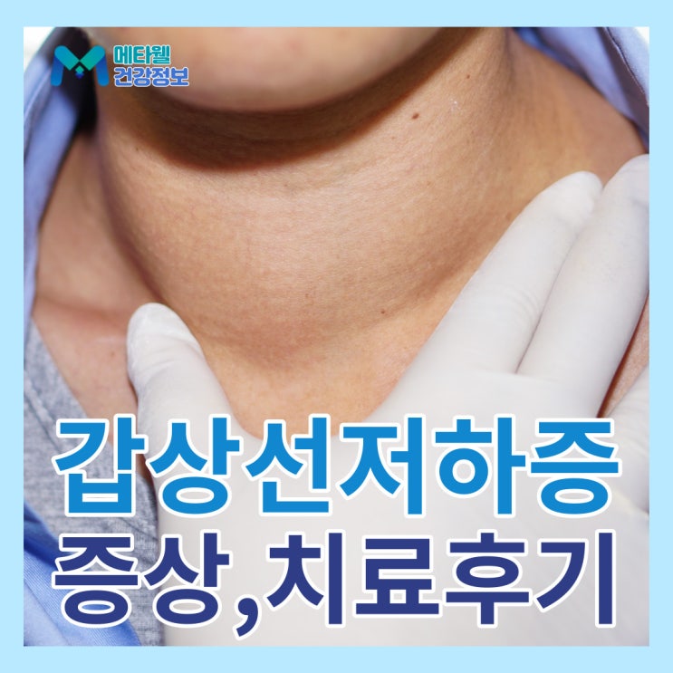  이유없는 체중증가, 탈모 갑상선기능저하증 의심해보세요. 갑상선저하증 원인 및 증상, 정상수치, 씬지로이드 복용후기